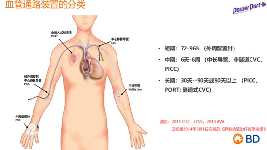 河北一洲肿瘤医院引进耐高压静脉输液港 为肿瘤患者打通长期“生命通路”